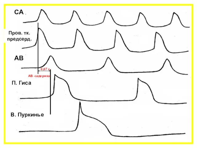 СА Пров. тк. предсерд. АВ П. Гиса В. Пуркинье АВ -задержка 0,07 с