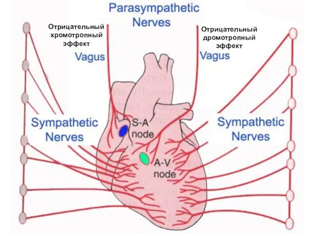 Отрицательный хромотропный эффект Отрицательный дромотропный эффект