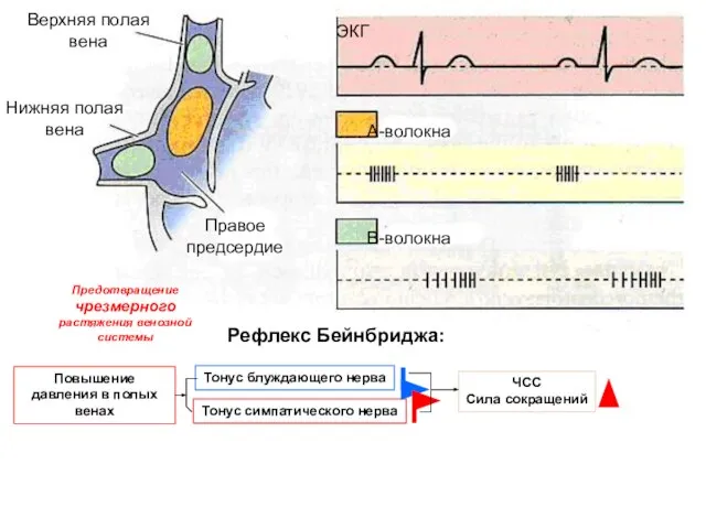 Рефлекс Бейнбриджа: ЭКГ А-волокна В-волокна Верхняя полая вена Нижняя полая вена Правое