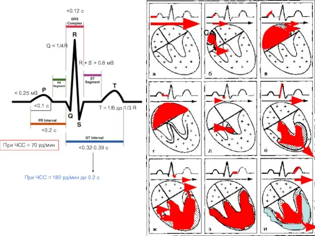 При ЧСС = 70 уд/мин 0.2 с При ЧСС = 180 уд/мин