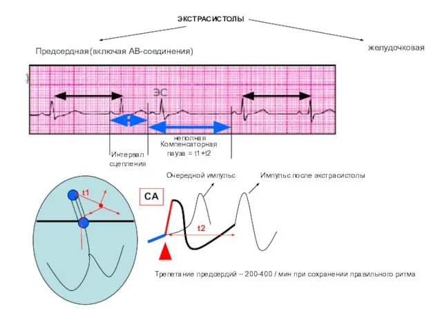 ЭКСТРАСИСТОЛЫ Предсердная (включая АВ-соединения) желудочковая Очередной импульс Импульс после экстрасистолы t1 t2