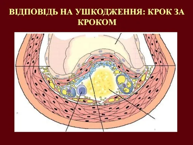 ВІДПОВІДЬ НА УШКОДЖЕННЯ: КРОК ЗА КРОКОМ