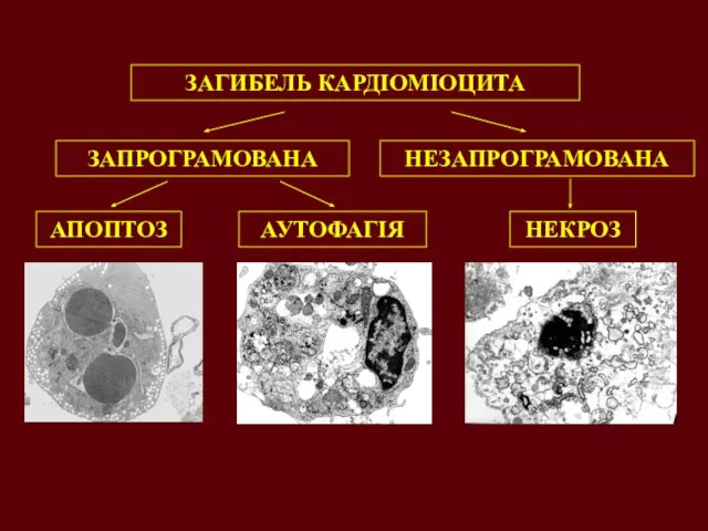 ЗАГИБЕЛЬ КАРДІОМІОЦИТА ЗАПРОГРАМОВАНА НЕЗАПРОГРАМОВАНА АПОПТОЗ АУТОФАГІЯ НЕКРОЗ