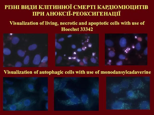РІЗНІ ВИДИ КЛІТИННОЇ СМЕРТІ КАРДІОМІОЦИТІВ ПРИ АНОКСІЇ-РЕОКСИГЕНАЦІЇ Visualization of living, necrotic and