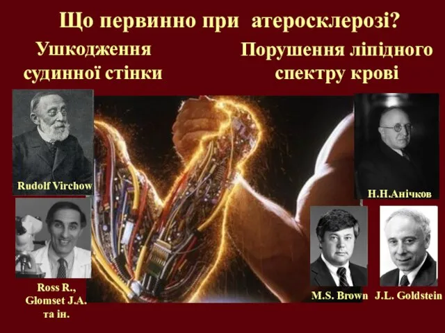 Що первинно при атеросклерозі? Ушкодження судинної стінки Порушення ліпідного спектру крові Rudolf