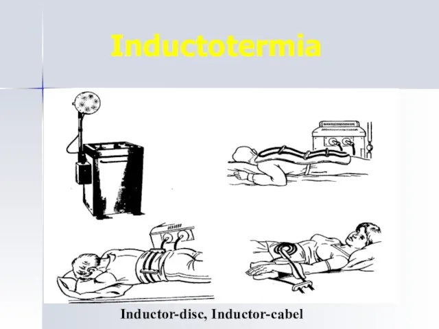 Inductotermia Inductor-disc, Inductor-cabel