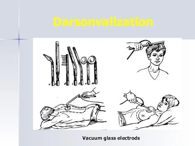 Darsonvalization Vacuum glass electrods