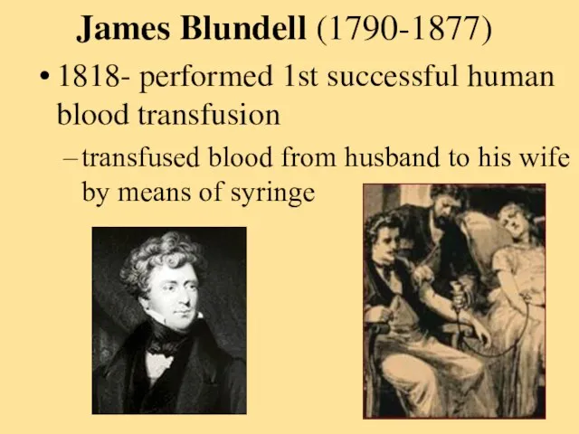 James Blundell (1790-1877) 1818- performed 1st successful human blood transfusion transfused blood