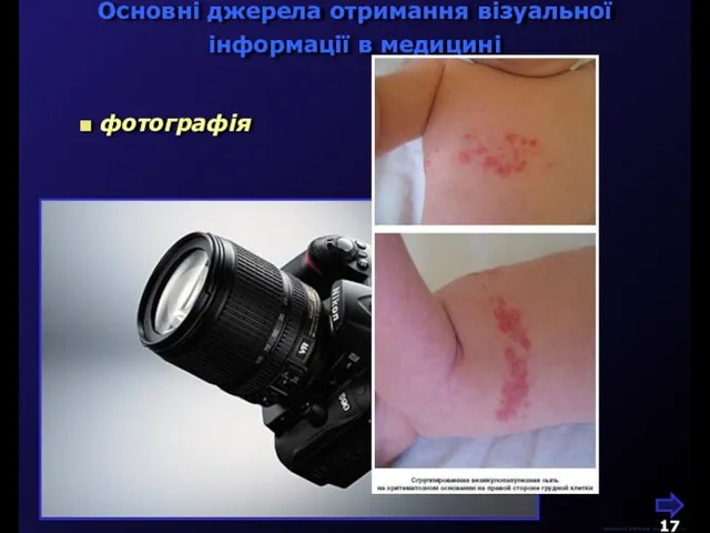 фотографія Основні джерела отримання візуальної інформації в медицині М.Кононов © 2009 E-mail: mvk@univ.kiev.ua