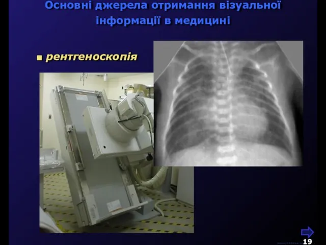 рентгеноскопія Основні джерела отримання візуальної інформації в медицині М.Кононов © 2009 E-mail: mvk@univ.kiev.ua