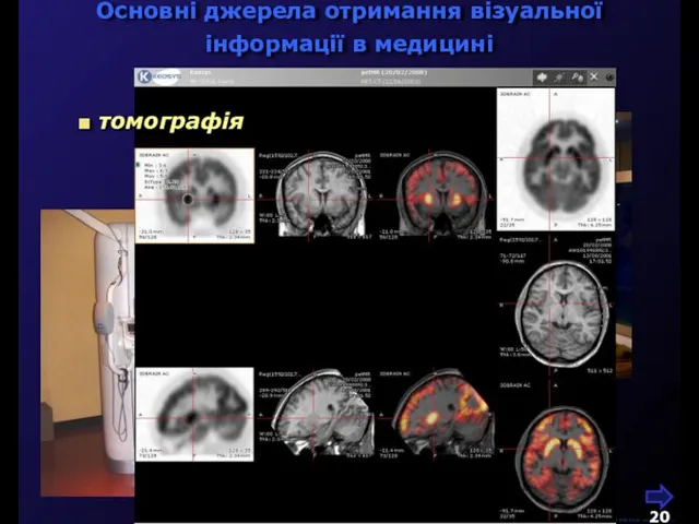 Основні джерела отримання візуальної інформації в медицині М.Кононов © 2009 E-mail: mvk@univ.kiev.ua томографія