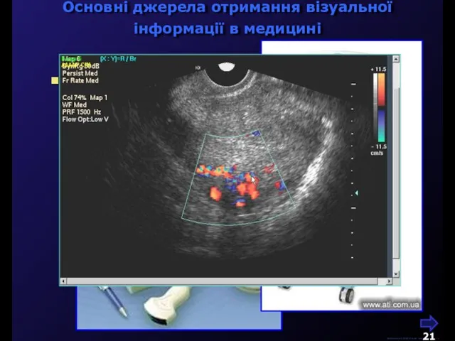 Основні джерела отримання візуальної інформації в медицині М.Кононов © 2009 E-mail: mvk@univ.kiev.ua ультразвукове сканування