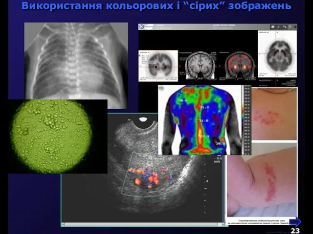 М.Кононов © 2009 E-mail: mvk@univ.kiev.ua Використання кольорових і “сірих” зображень