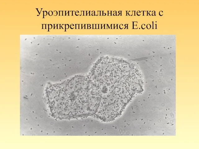 Уроэпителиальная клетка с прикрепившимися E.coli