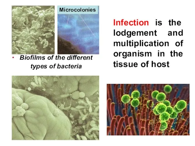 Infection is the lodgement and multiplication of organism in the tissue of