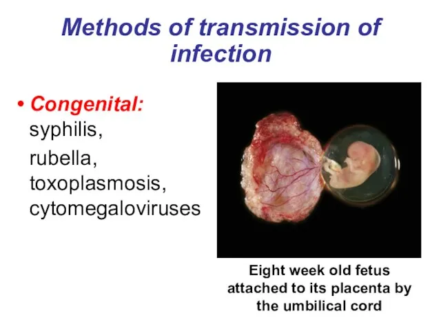 Methods of transmission of infection Congenital: syphilis, rubella, toxoplasmosis, cytomegaloviruses Eight week