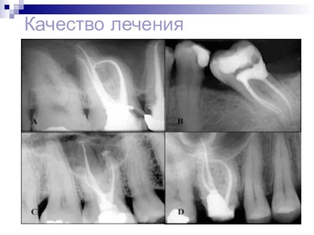 Качество лечения