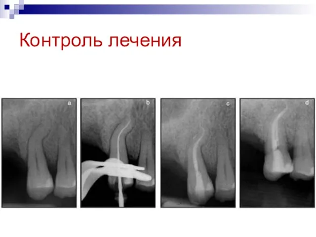 Контроль лечения