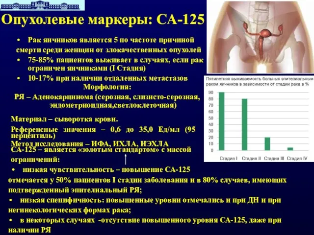 Опухолевые маркеры: СА-125 Рак яичников является 5 по частоте причиной смерти среди