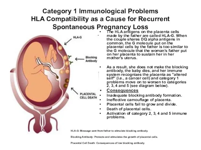 Category 1 Immunological Problems HLA Compatibility as a Cause for Recurrent Spontaneous