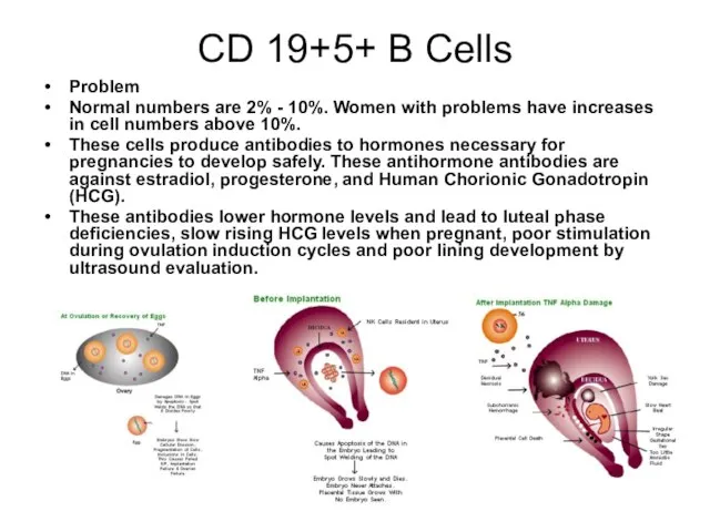 CD 19+5+ B Cells Problem Normal numbers are 2% - 10%. Women