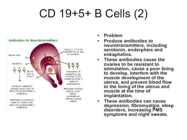 CD 19+5+ B Cells (2) Problem Produce antibodies to neurotransmitters, including serotonin,