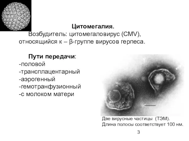 Цитомегалия. Возбудитель: цитомегаловирус (СМV), относящийся к – β-группе вирусов герпеса. Пути передачи:
