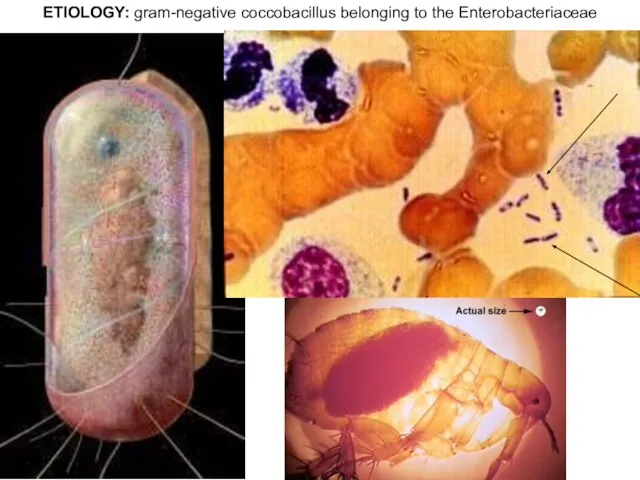ETIOLOGY: gram-negative coccobacillus belonging to the Enterobacteriaceae