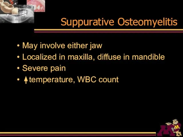 Suppurative Osteomyelitis May involve either jaw Localized in maxilla, diffuse in mandible