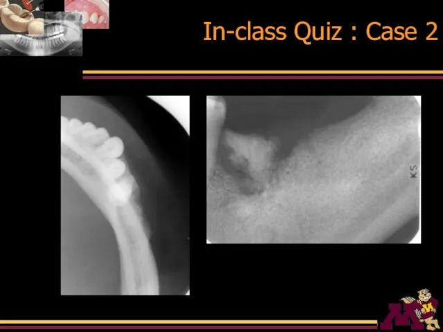 In-class Quiz : Case 2