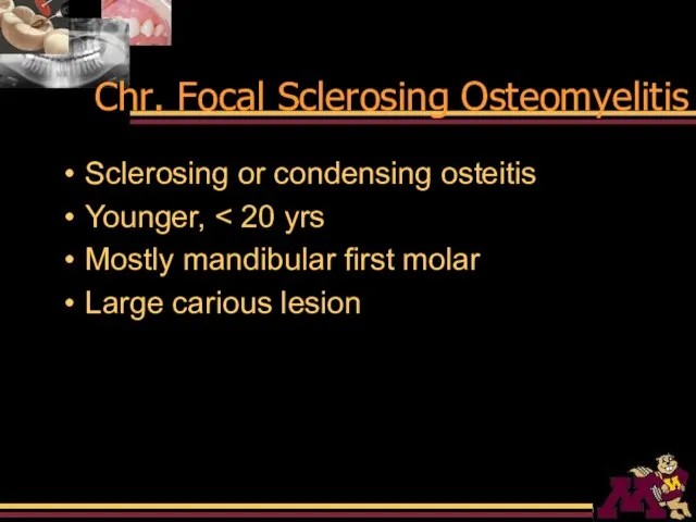 Chr. Focal Sclerosing Osteomyelitis Sclerosing or condensing osteitis Younger, Mostly mandibular first molar Large carious lesion