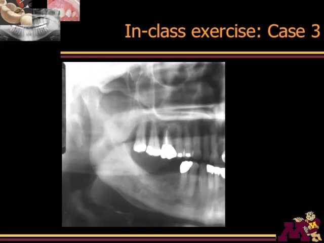 In-class exercise: Case 3