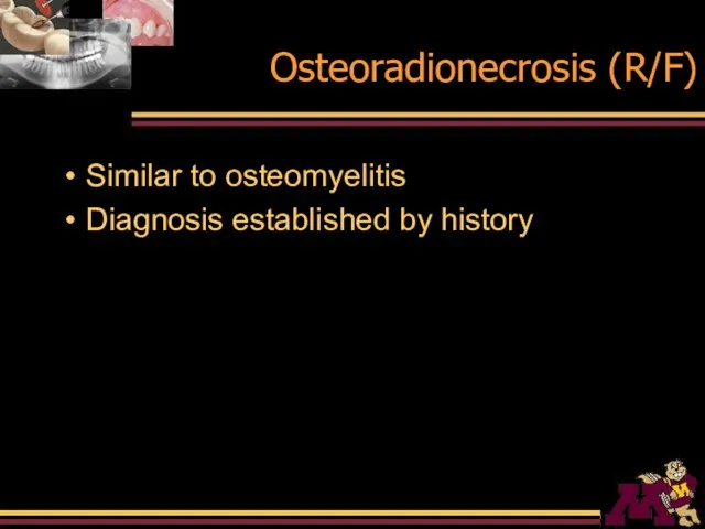 Osteoradionecrosis (R/F) Similar to osteomyelitis Diagnosis established by history