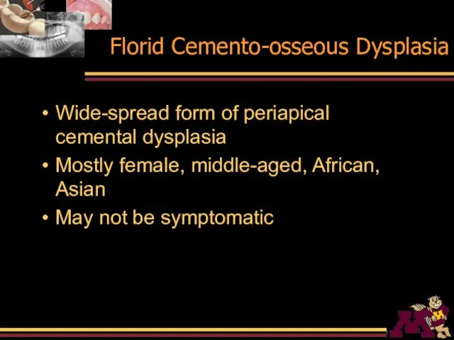Florid Cemento-osseous Dysplasia Wide-spread form of periapical cemental dysplasia Mostly female, middle-aged,