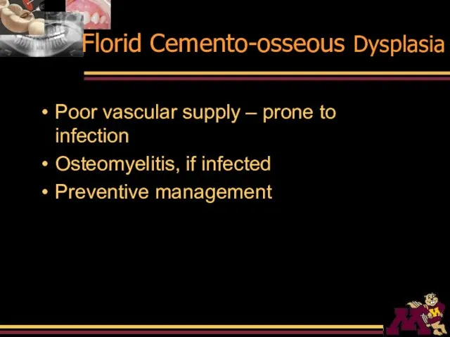 Florid Cemento-osseous Dysplasia Poor vascular supply – prone to infection Osteomyelitis, if infected Preventive management