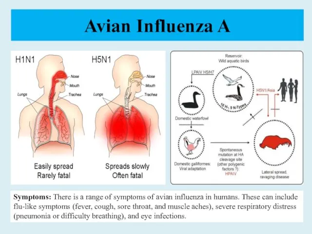 Avian Influenza A Symptoms: There is a range of symptoms of avian