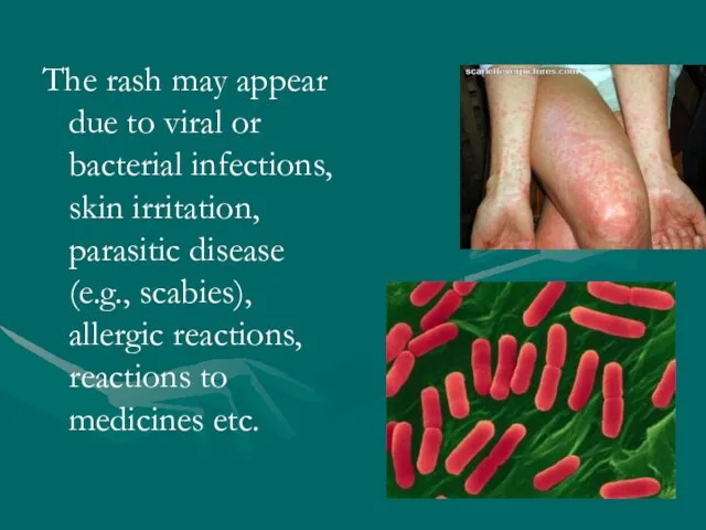 The rash may appear due to viral or bacterial infections, skin irritation,