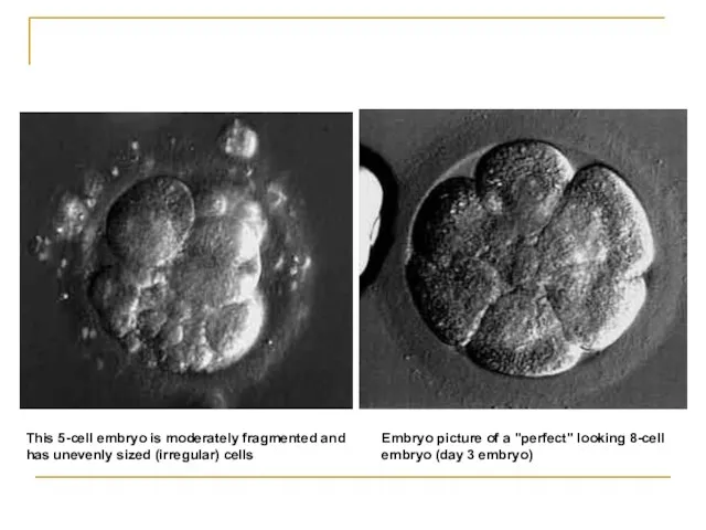 Embryo picture of a "perfect" looking 8-cell embryo (day 3 embryo) This