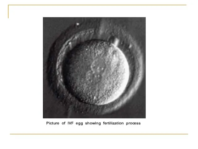 Picture of IVF egg showing fertilization process