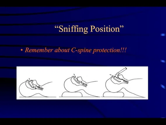 “Sniffing Position” Remember about C-spine protection!!!