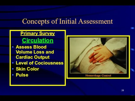 Concepts of Initial Assessment Primary Survey Circulation Assess Blood Volume Loss and