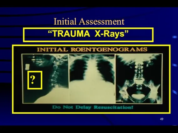 Initial Assessment “TRAUMA X-Rays” ?