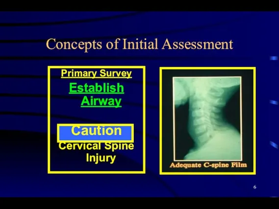 Concepts of Initial Assessment Primary Survey Establish Airway Caution Cervical Spine Injury