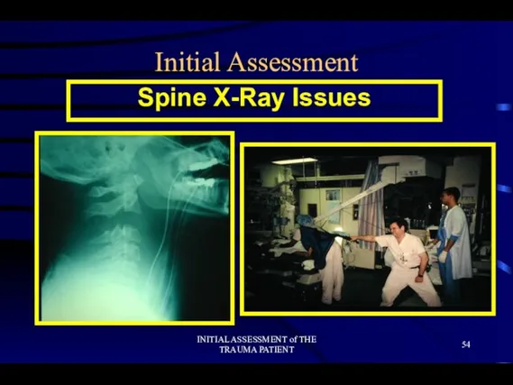 INITIAL ASSESSMENT of THE TRAUMA PATIENT Initial Assessment Spine X-Ray Issues