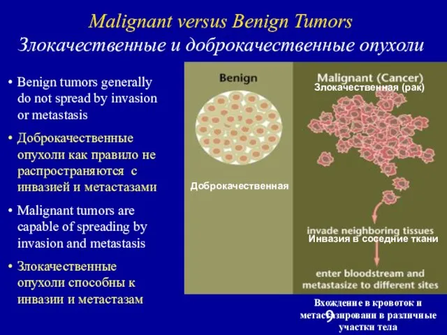 Benign tumors generally do not spread by invasion or metastasis Доброкачественные опухоли