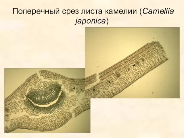 Поперечный срез листа камелии (Camellia japonica)