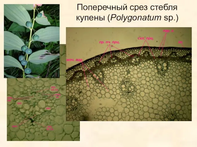 Поперечный срез стебля купены (Polygonatum sp.)