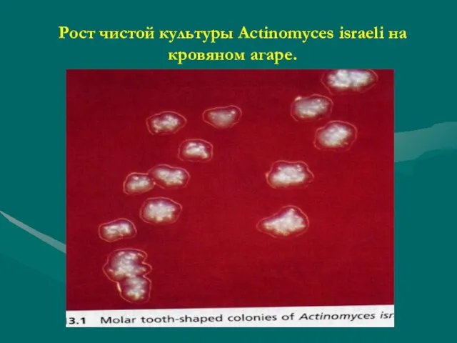 Рост чистой культуры Actinomyces israeli на кровяном агаре.