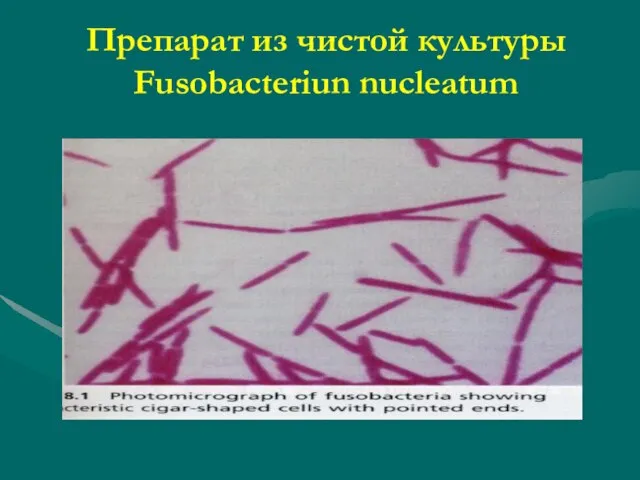 Препарат из чистой культуры Fusobacteriun nucleatum