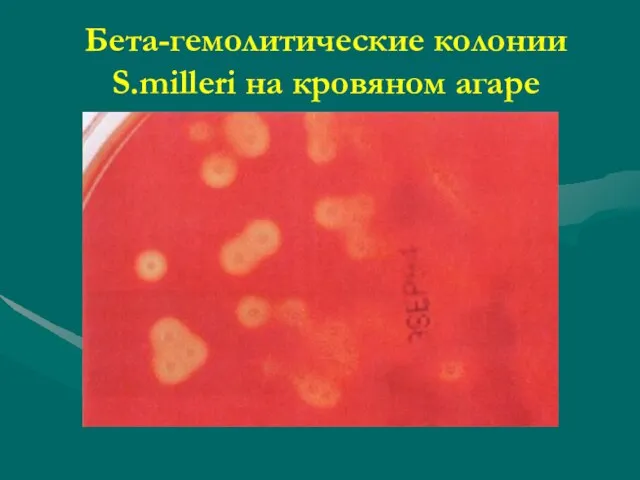 Бета-гемолитические колонии S.milleri на кровяном агаре